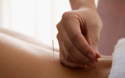 Acupuncture and Chronic PainNEW 